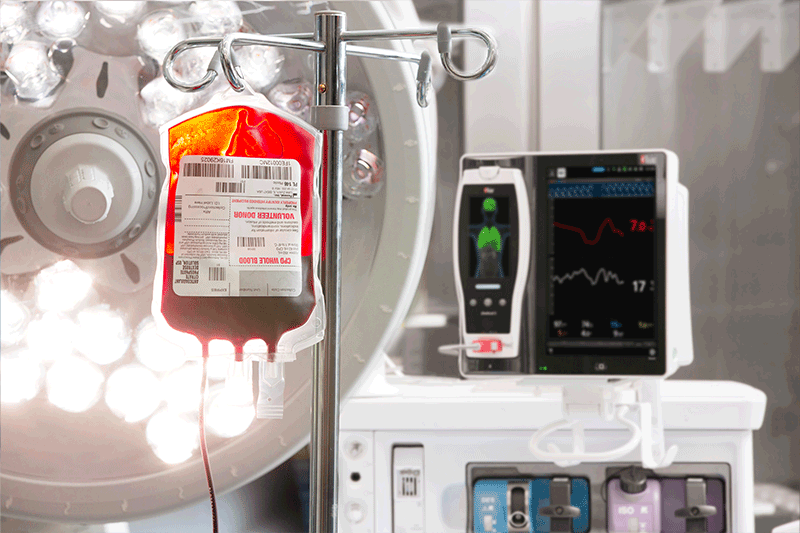 sacca di sangue vicina a Masimo Root